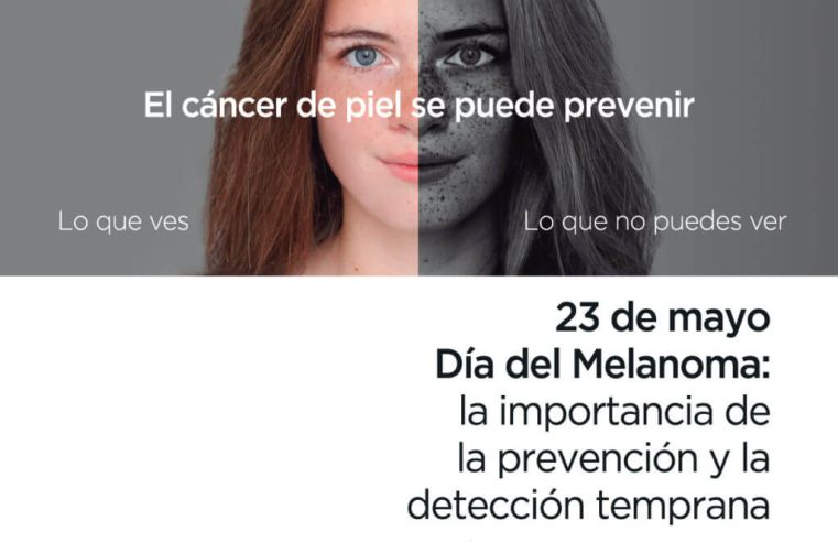 En el Día Mundial del Melanoma, la Liga Colombiana Contra el Cáncer alienta atomar medidas de prevención para evitar este cáncer, el más invasor en su tipo