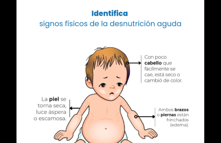 |Sopó| promueve la |detección temprana| de la |desnutrición infantil| + Video