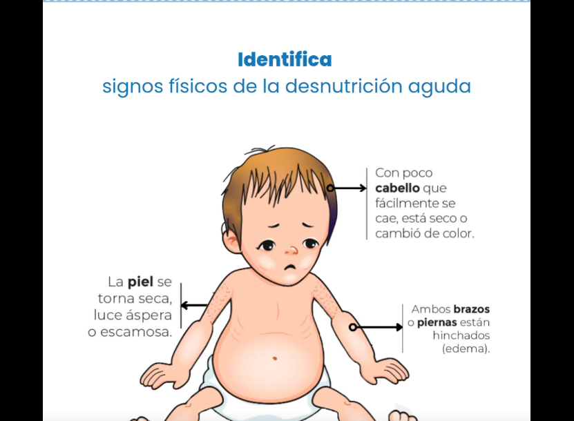 |Sopó| promueve la |detección temprana| de la |desnutrición infantil| + Video